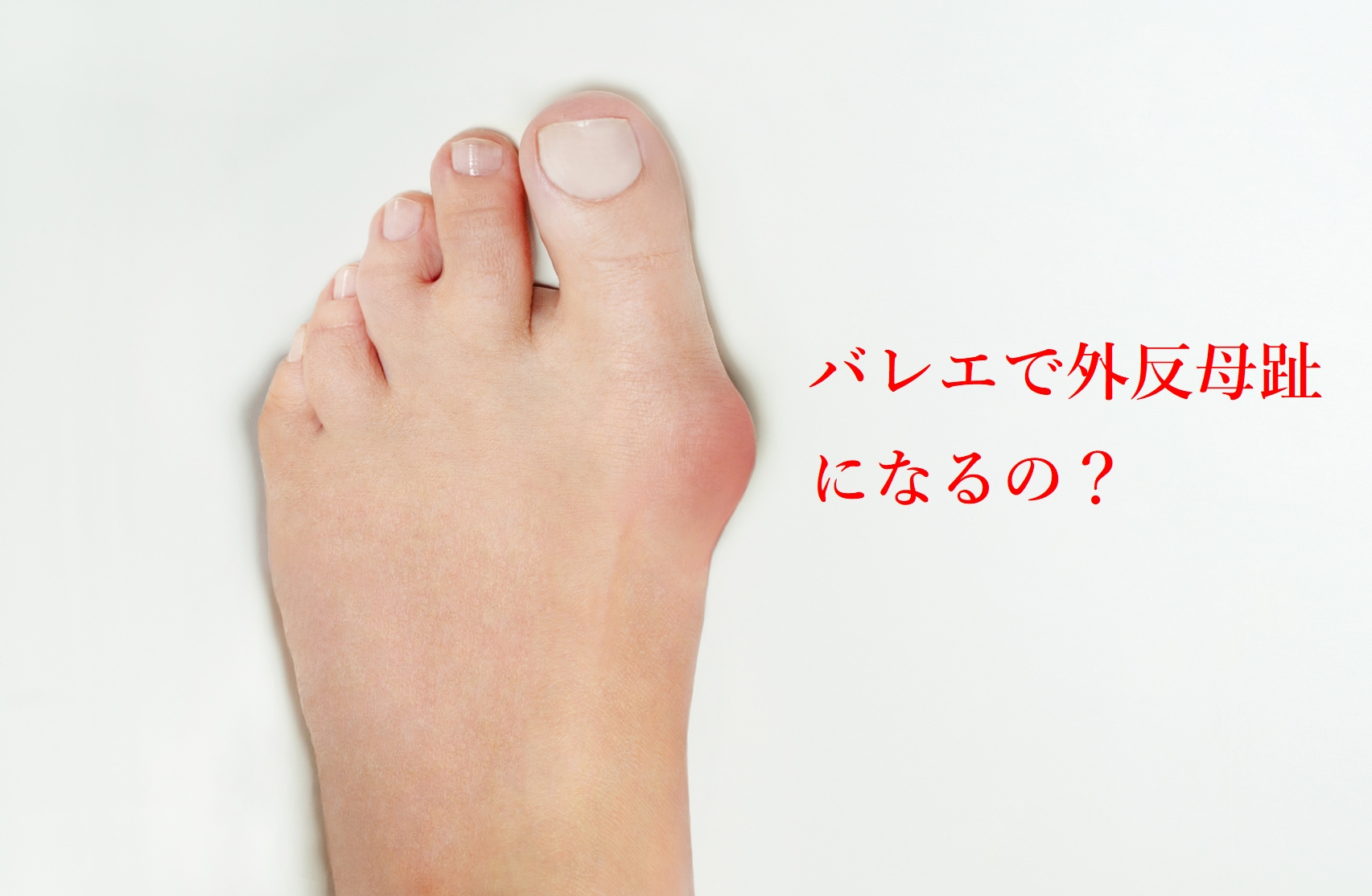 バレエで外反母趾になる バレリィーノ トレーニング バレエで外反母趾になる バレリィーノ トレーニング